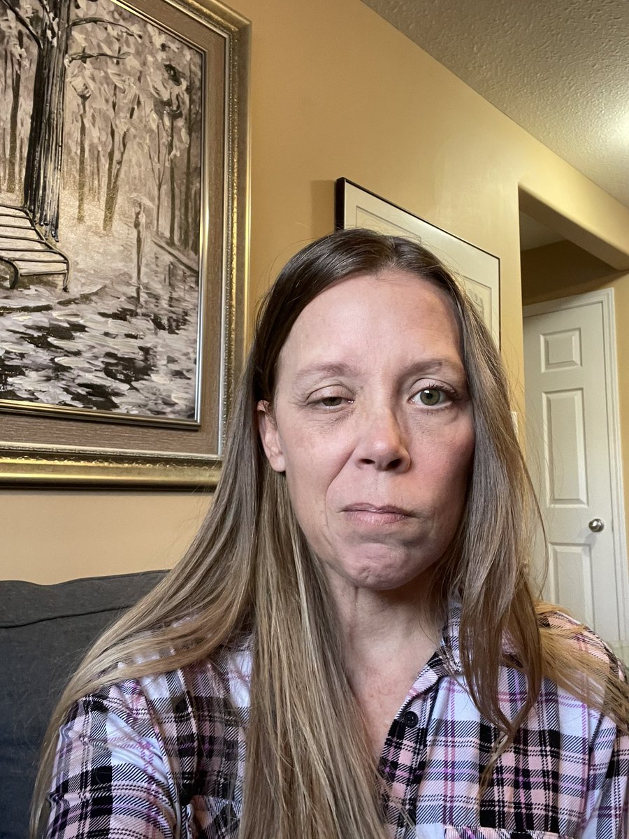 If you know the story of my Vaccine Injury then you know my face is now paralyzed. Do you tell people about me? Do they believe you? Do you think I am making a difference by speaking up?