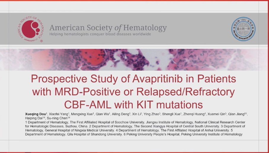 TalhaBadarMD's tweet photo. #ASH24 Avapritinib in RR or MRD+ cKitm core binding factor AML 👇🏽

Time to response 2-3 cycles 

Better responses with MRD+ disease compared to RR #leusm https://t.co/p0kxVT6Nfm