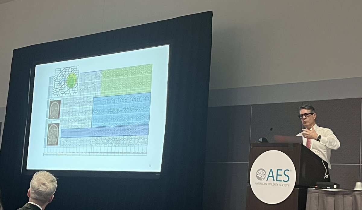 Alexandra Urban (@alexandraurban_) on Twitter photo Fantastic session at the #AES2024 SEEG SIG: Avoiding Memory and Language Deficits in SEEG-Guided Surgery. An incredible journey through cases presented by neurosurgeon, Dr. Jorge GonzĂĄlez-MartĂnez, MD, PhD. #EpilepsySurgery #UPMC
<a href="/PittEpilepsy/">Pitt Epilepsy</a> <a href="/PittNeurosurg/">Pitt Neurosurgery</a> <a href="/AmEpilepsySoc/">American Epilepsy Society</a> Fantastic session at the #AES2024 SEEG SIG: Avoiding Memory and Language Deficits in SEEG-Guided Surgery. An incredible journey through cases presented by neurosurgeon, Dr. Jorge GonzĂĄlez-MartĂnez, MD, PhD. #EpilepsySurgery #UPMC
<a href="/PittEpilepsy/">Pitt Epilepsy</a> <a href="/PittNeurosurg/">Pitt Neurosurgery</a> <a href="/AmEpilepsySoc/">American Epilepsy Society</a>