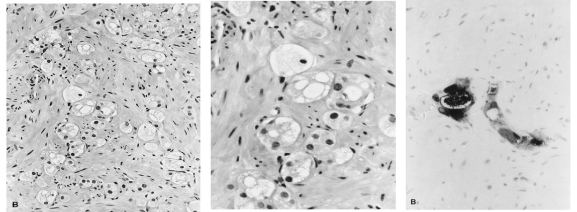 UroToday.com tweet media