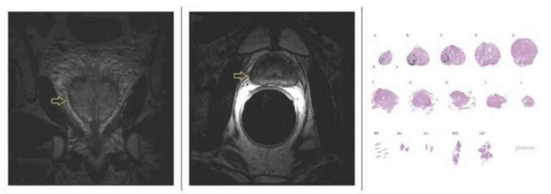 UroToday.com tweet media