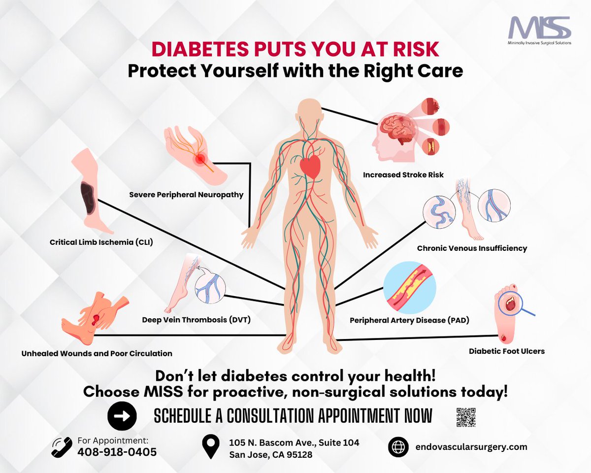 Don't let diabetes control you. Stay ahead of these risk with our non-invasive, patient-centred care.

📞 (408) 918-0405 
📍 105 N. Bascom Ave., San Jose, CA
🔗 arashpadidar.com

 #DiabetesAwareness #FootHealth #MISS #SanJose #Diabetes #diabeticfoot