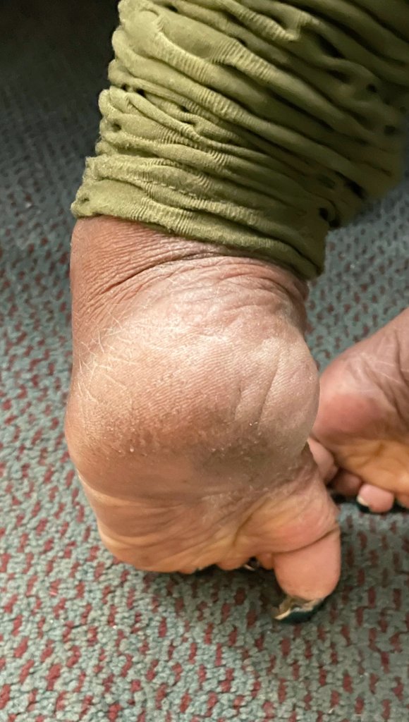 #dirtysoles 
#drysoles 
#dryfootheels 
#smellysoles 
#longtoenails 
#wrinkledsoles