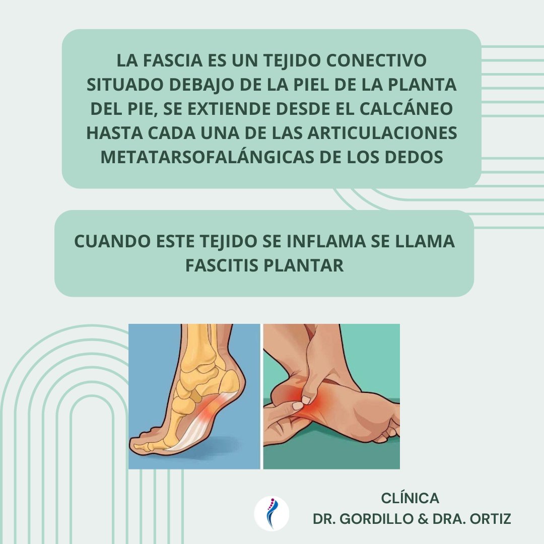 DoctoresDelPie's tweet photo. FASCITIS PLANTAR 👣 https://t.co/GJeeuV1Yrh