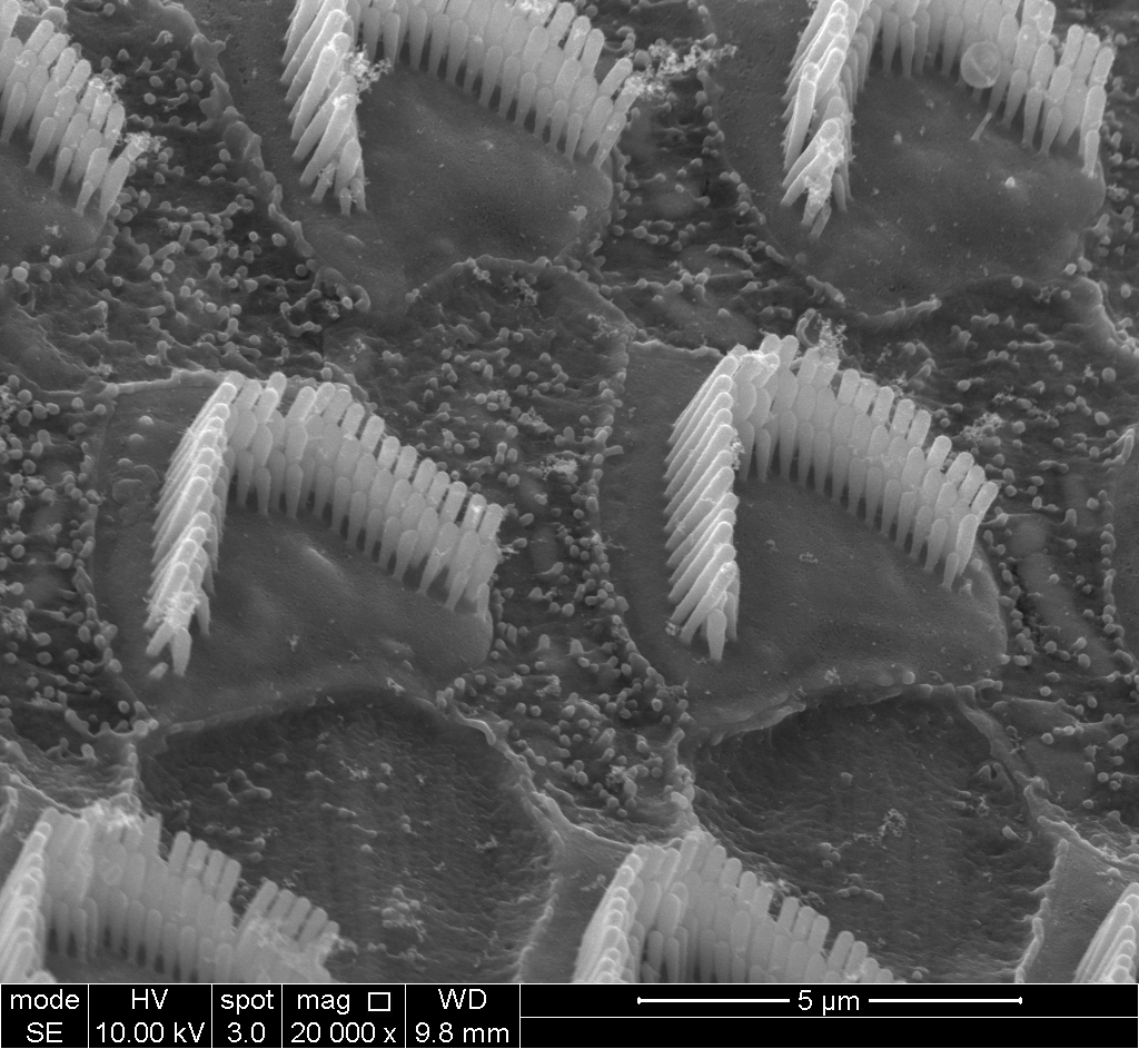 HearingShef's tweet photo. Happy #MicroscopyMonday, everyone! This week, we're up close and personal with the stereocilia of some outer hair cells (image courtesy of Sam). Seeing all three rows of each hair bundle so clearly is a beautiful sight indeed 🤩. https://t.co/N2sqxIAHaU