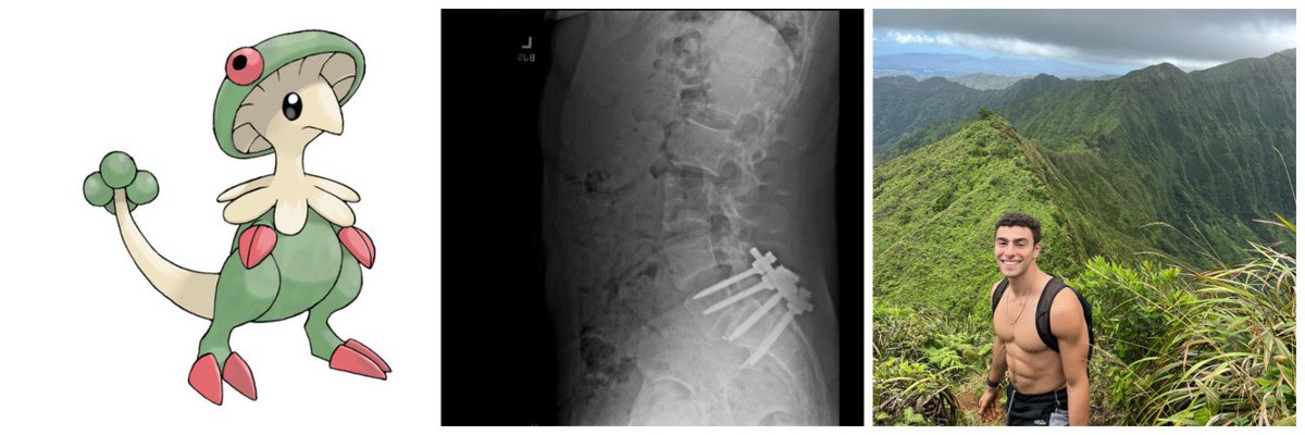 esjesjesj's tweet image. Can’t get over his banner. Pokemon, the surgery that most likely radicalized him, thirst trap