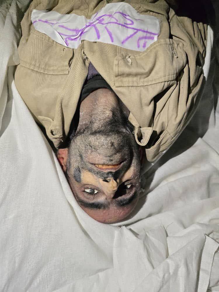 InsideIdlib's tweet photo. Sorry for the harsh scenes

Pictures of some of the bodies found in Sednaya prison

Allah is sufficient for us, and He is the best Disposer of affairs. https://t.co/nRNKvMq54u
