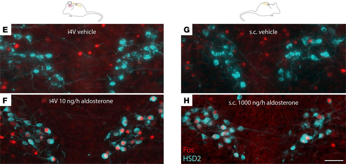 JCI insight (@jci_insight) on Twitter photo What neurons drive increased salt intake in response to aldosterone? insight.jci.org/articles/view/…
Silvia Gasparini and colleagues show that HSD2 neurons are required for aldosterone-induced salt intake.
<a href="/geerling_lab/">Joel Geerling</a> <a href="/uiowa/">University of Iowa</a> @iowamed @iowaneurology @uiowaneuro @uipathology What neurons drive increased salt intake in response to aldosterone? insight.jci.org/articles/view/…
Silvia Gasparini and colleagues show that HSD2 neurons are required for aldosterone-induced salt intake.
<a href="/geerling_lab/">Joel Geerling</a> <a href="/uiowa/">University of Iowa</a> @iowamed @iowaneurology @uiowaneuro @uipathology