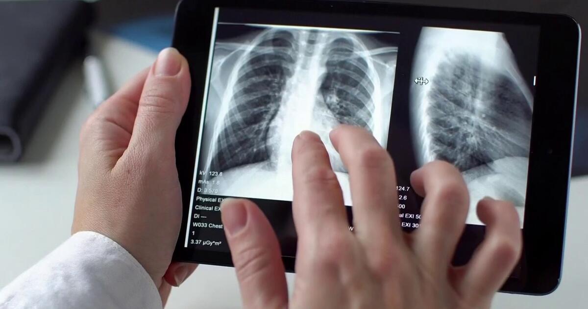 hoydia's tweet photo. ❄️💨 Protege tus pulmones en época de frío con estos consejos #EnHoy Día te decimos cómo cuidar tu salud durante los meses más fríos ¡No pongas en riesgo tu salud! 🫁❤️ #SaludPulmonar #ConsejosDeInvierno https://t.co/jQVmpR4Tfs https://t.co/xLFb3I7Zn5