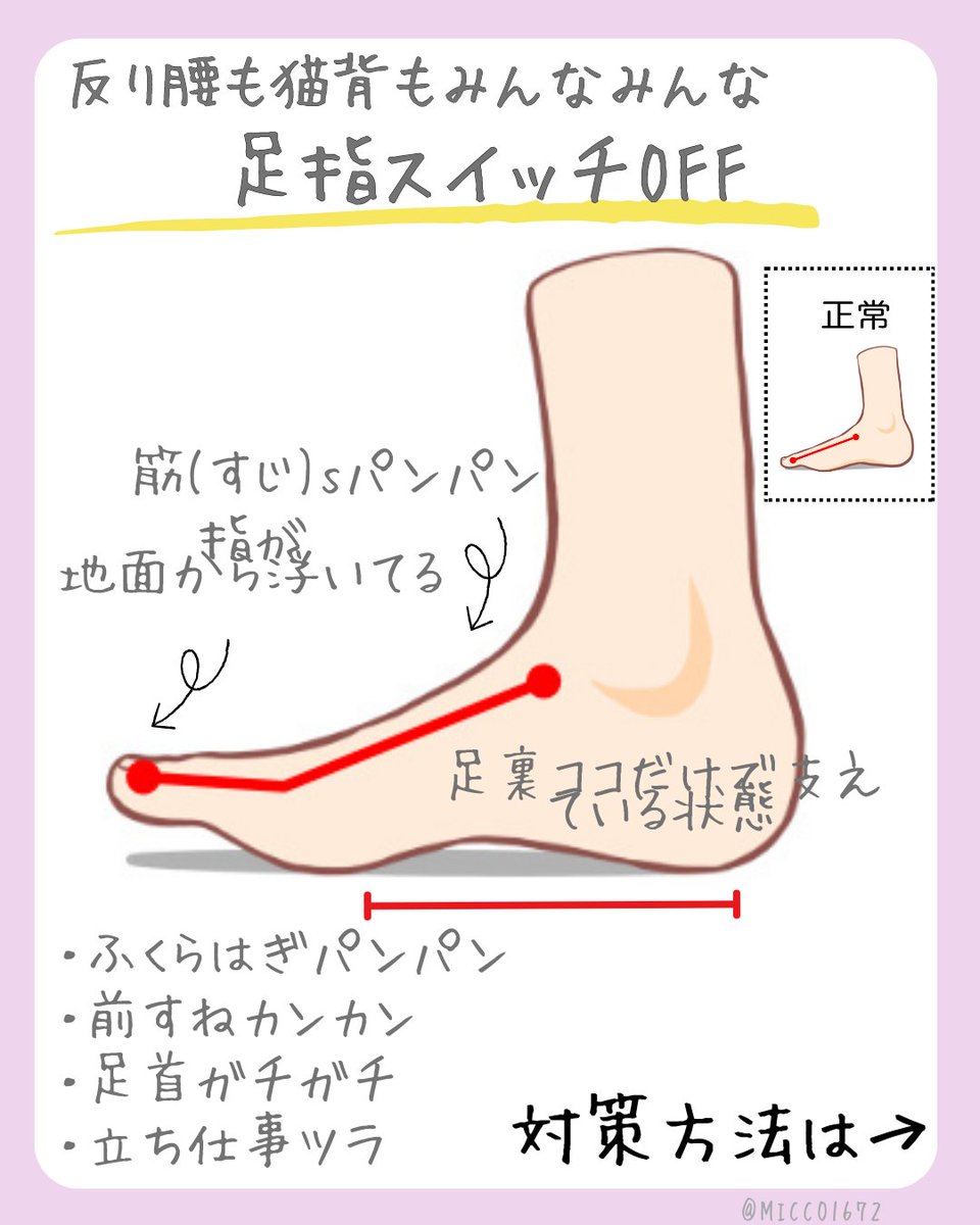 MICCO1672's tweet photo. 骨盤のプロが「９割の人が足指つかえてません」と言っていたのが超当てはまっていたのでシェア https://t.co/CaYwYTjcIc