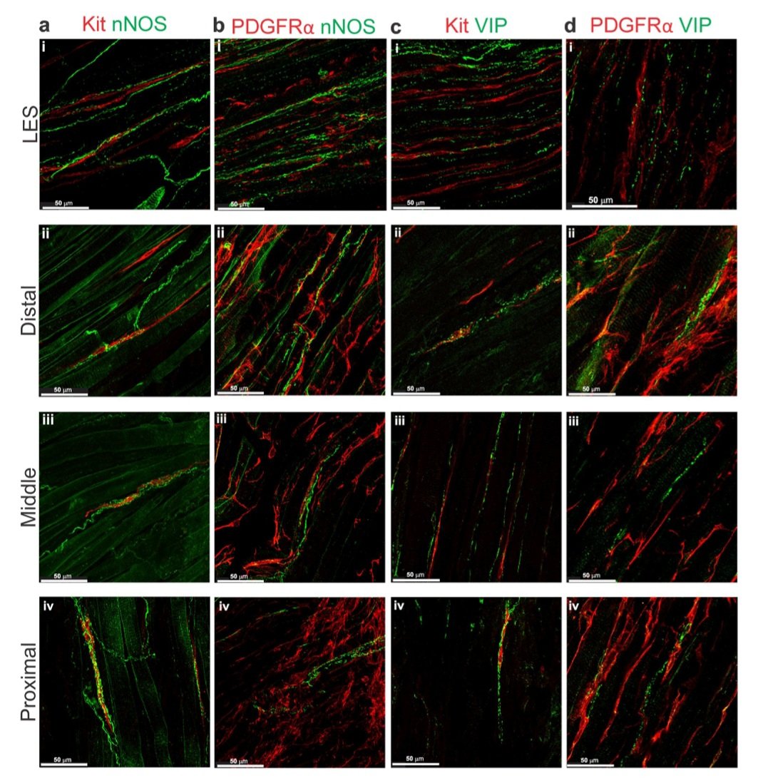 Such an amazing study‼️ 
✨️Beautiful immunihistichemistry🔥
✅️ICC &amp; neurons proximity
🎯Spatial relationship to interstitial cells
#Esophagus #LES
Kudos to <a href="/Emernib11/">Emer Ni Bhraonain</a> 👏
Many Congratulations 🎊  <a href="/CobineLab/">Caroline Cobine</a> <a href="/unrmed/">UNR Med</a>
👉link.springer.com/article/10.100… 🎉