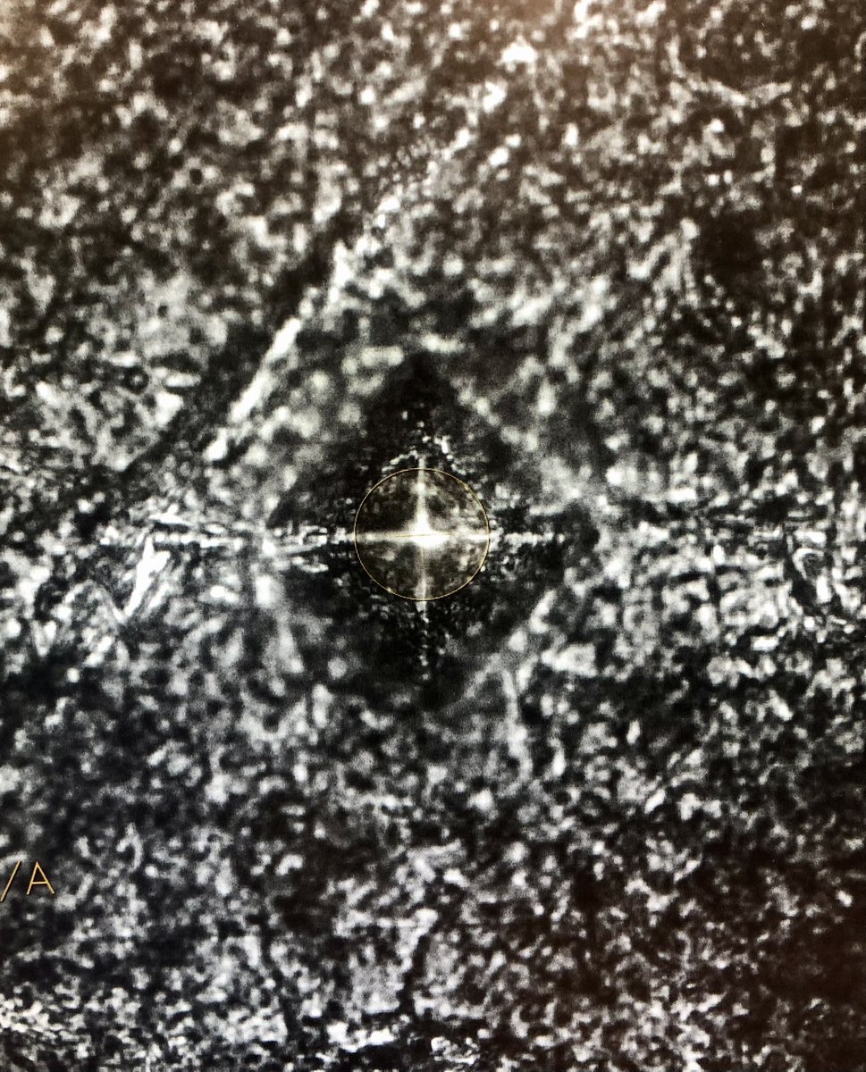 scimediapro's tweet photo. How do scientists measure the hardness of a material?!🔬🥼💎

Vickers Hardness Test:

A pyramid indenter made out of diamond 💎 is forced into the surface of the material under a known load.

The tester has to be made out of diamond because it is the hardest known material. 

If two materials meet, the harder material will deform the softer material. 

After removing the load, the indent left by the diamond creates a square impression. 

The diagonals of this square are measured with a microscope. 

Hardness is calculated with these measurements.

Hardness = (1.8544×P) / (d^2)

P = Load
d = Average length of the two diagonals