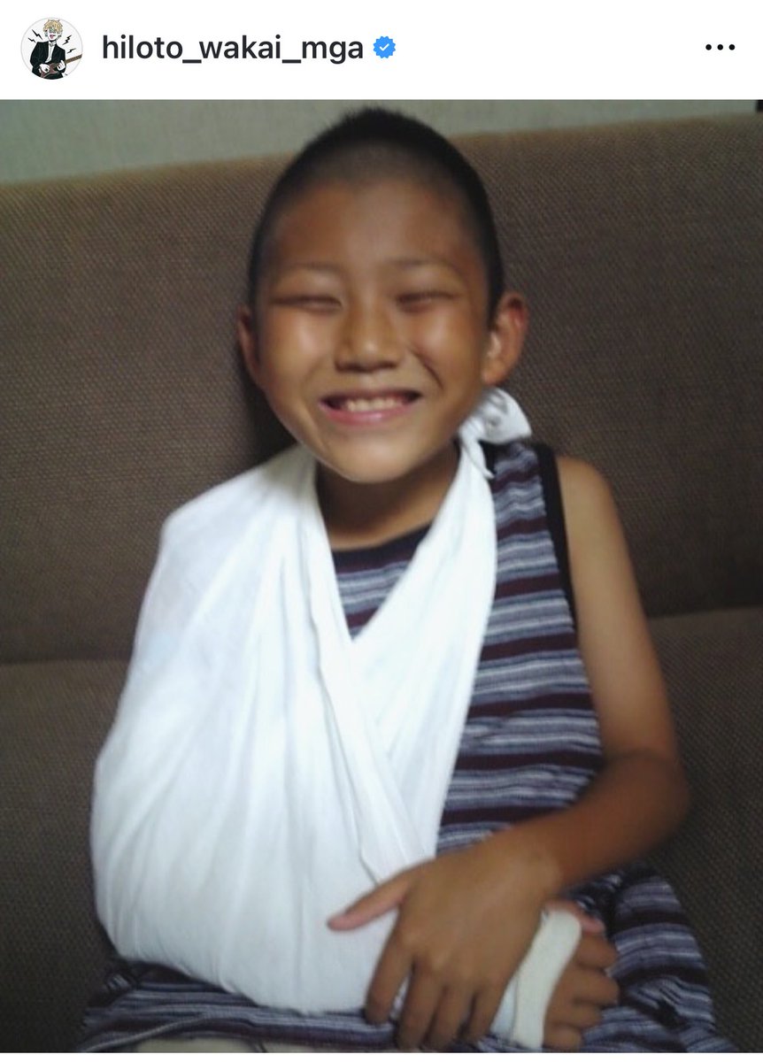 昨日からなんか既視感あると思ったけど3回目見てやっと分かった！ 骨折