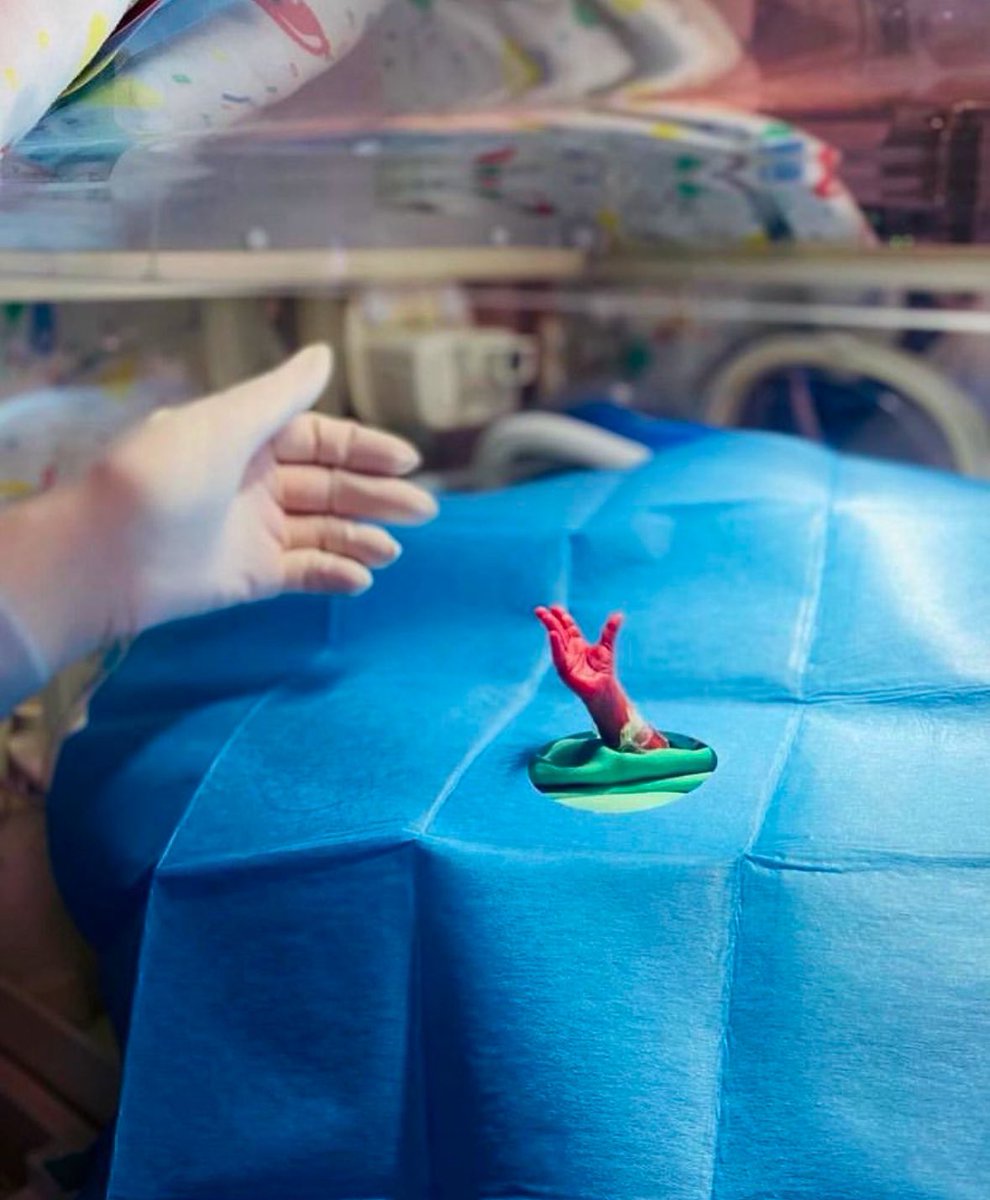 annamlulis's tweet photo. A preterm baby's hand reaching for life.
She was born at 24 weeks.
Most babies at that age are called “just a clump of cells” and aborted.
She may be underdeveloped, but she is equally human and worthy of life.
A child’s age doesn’t determine their humanity. https://t.co/bldXTHvzRP