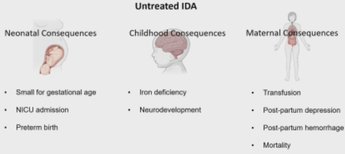 DrDavidJYoung's tweet photo. Iron deficiency is a critical issue during pregnancy. Oral repletion is inefficient with side effects. Traditional IV is intensive. Mary Morgan (@Sunnybrook @uoftmedicine) provides compelling data for ferric derisomaltose total dose infusion to treat pregnancy related #IDA #ASH24 https://t.co/40ukUdSaTa