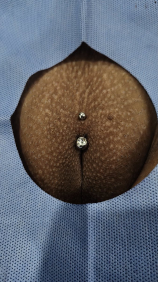 nick_piercing's tweet photo. Piercing intimo que rolou https://t.co/94FoWQ7g3K