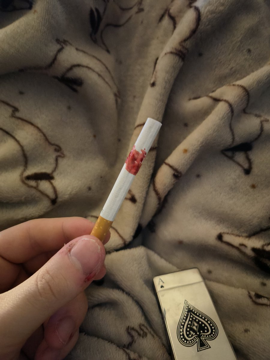 cum_maker_bed's tweet photo. Boutta smoke some of my blood https://t.co/MufkfGPixm