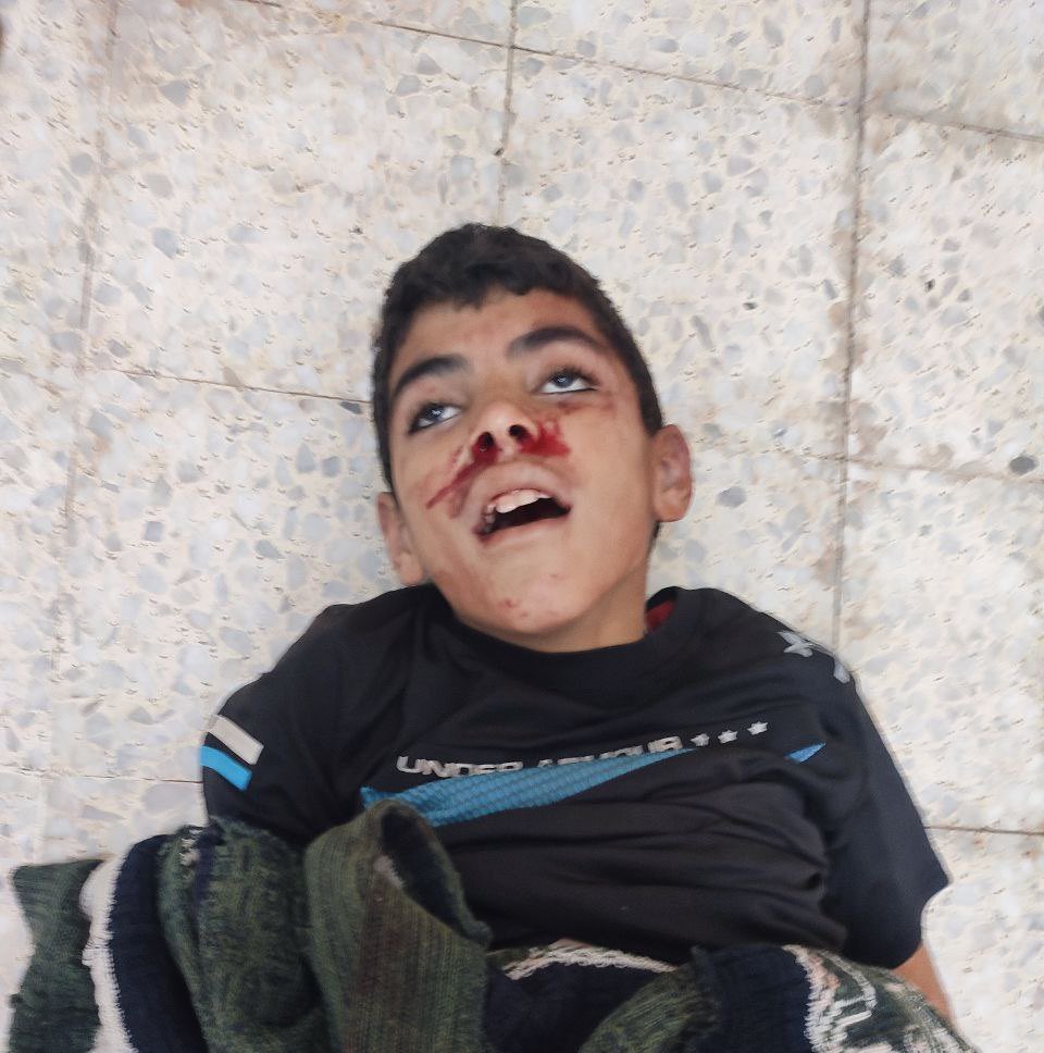 In an Israeli attack targeting civilians in the western part of the Nuseirat Camp, a child named Samer Fadi Abdel was killed.