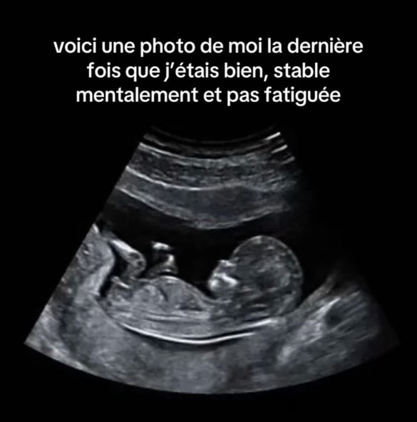 L’Échelle de Jacob (@leodmac47135) on Twitter photo 