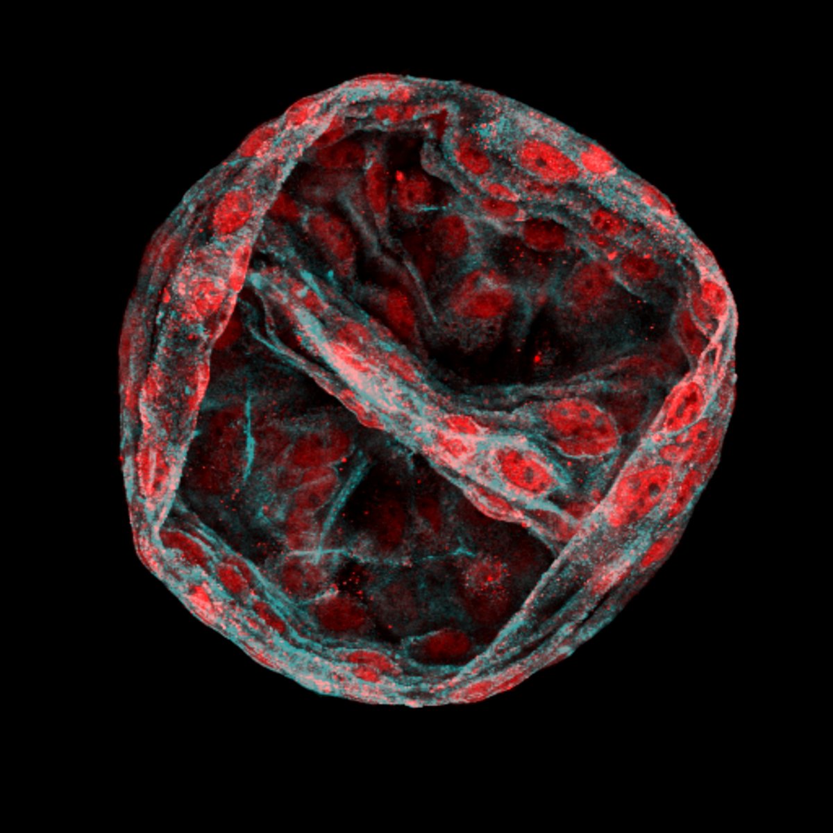 We made it among the BEST PICTURES OF THE YEAR by <a href="/Nature/">nature</a> 
nature.com/immersive/d415…
Beautiful image representing in red the nuclear localization of MTHFD2 in pluripotent colon organoids by <a href="/NataliaPardoL/">Natalia Pardo Lorente</a> 
Find the manuscript here: nature.com/articles/s4146…