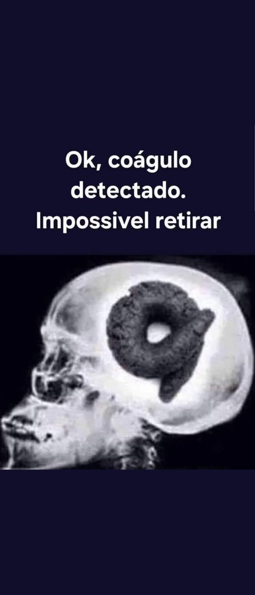 marta_s8's tweet photo. @GomesArtista @SolMariTerceiro @ThelmaDias10 O cérebro dele. https://t.co/mWC79vyB6D