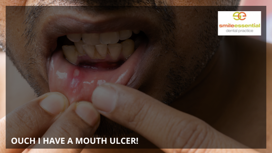 SmileEssential's tweet photo. Ouch! I Have a Mouth Ulcer! – Causes, Treatments, and Prevention Tips from Leicester’s Smile Essential Dental Practice: https://t.co/HRescAjPMp #mouthulcer https://t.co/X6464njEzY