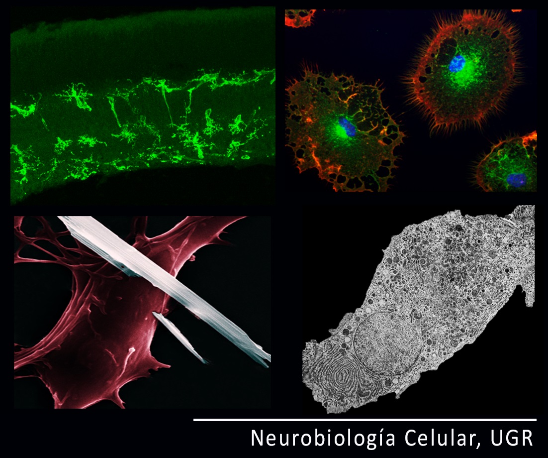 SENC_'s tweet photo. 🗓️🎄El #SENCalendiarioDeAdviento nos trae hoy una composición fotográfica realizada por el grupo de investigación en Neurobiología Celular @Neurobiougr de la @CanalUGR, que estudia principalmente la biología de las células microgliales en el Sistema Nervioso Central (sigue...) https://t.co/GADpSKiVpH