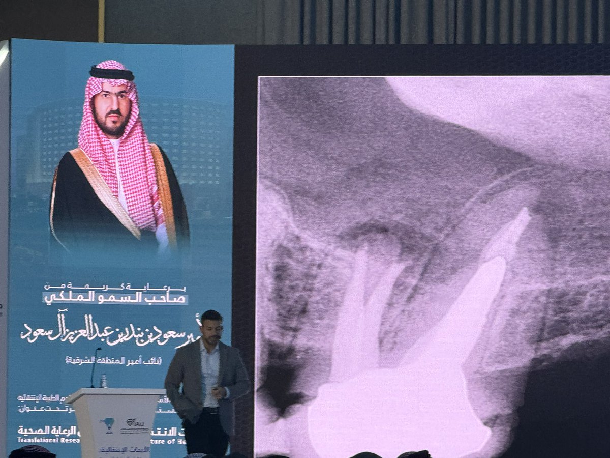 IAUdent's tweet photo. محاضرة علمية القاها الدكتور ادهم عبد العظيم رئيس قسم علاج جذور واعصاب الاسنان في جامعة باسيفيك بالولايات المتحدة الامريكية يتحدث عن
Micro-Surgery in Endodontics

#IAU_16ADS
#16ADS
#IAUdent https://t.co/ewZGhQBjwC