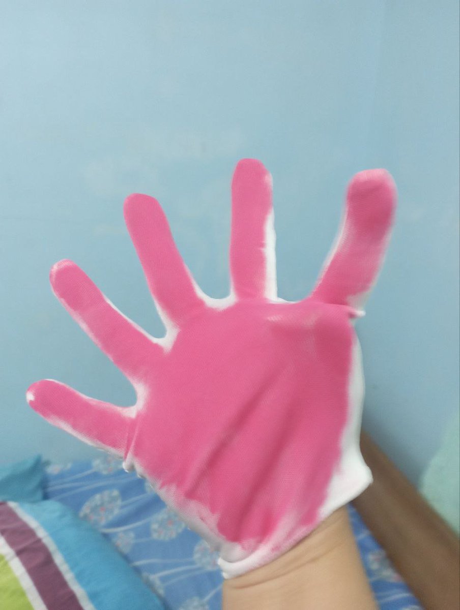 rataya3690's tweet photo. Gloves are...somewhat uncomfortable when you live in a 5-fingered world (u.u) #6fingers #polydactyly #seisdedos #6daliri #sixfingers #12fingers #extrafingers #special #uniquehand #sellingcontent #selling #fakebody #polidactilia https://t.co/uykX5QB8HF