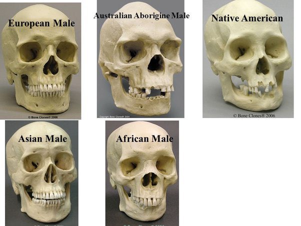 Uncommonsince76's tweet photo. It’s actually insane that Jewish Intellectuals have convinced the western world race is a “social construct”, while also simultaneously arguing they need a special racial ethnostate in the Middle East. 

On top of that you have all of the biological physical evidence of racial differences. 

Propaganda is a hell of a drug.