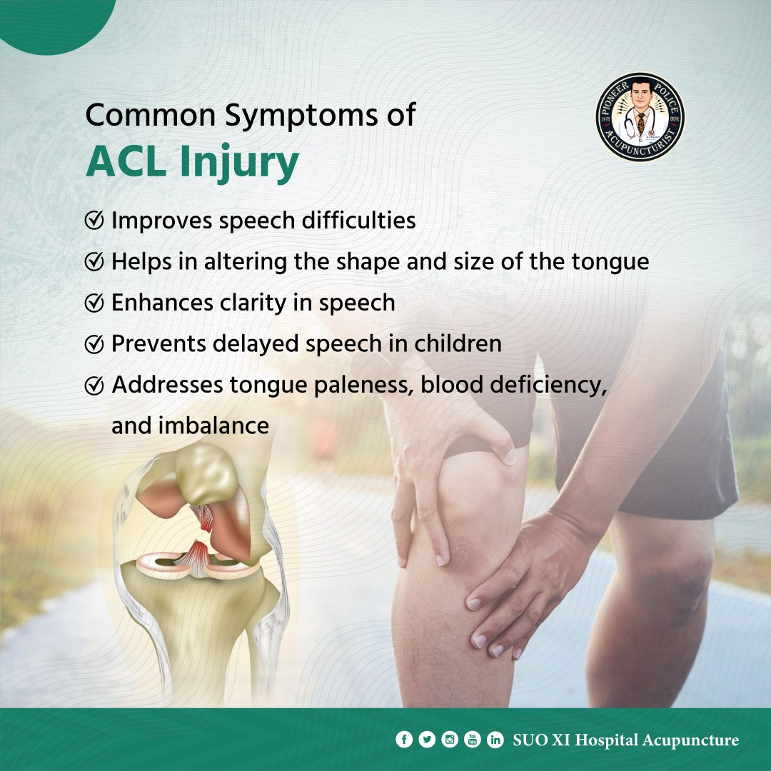DrSMShahidulIs1's tweet photo. Don't Ignore These ACL Injury Symptoms. It could harm you so badly.
#ACLInjury #KneePain #SportsInjury #Fitness #painful #HealthTips #drislam #Bitcoin #MiddleEast #Twitter https://t.co/I8bLs1iZs9