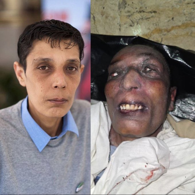 CodeHuman07's tweet photo. Mazen al-Hamada, before and after being tortured in the Sednaya dungeons.

#Syria #سجن_صيدنايا #SednayaPrison #FreeSyria https://t.co/F82lI4L2x7