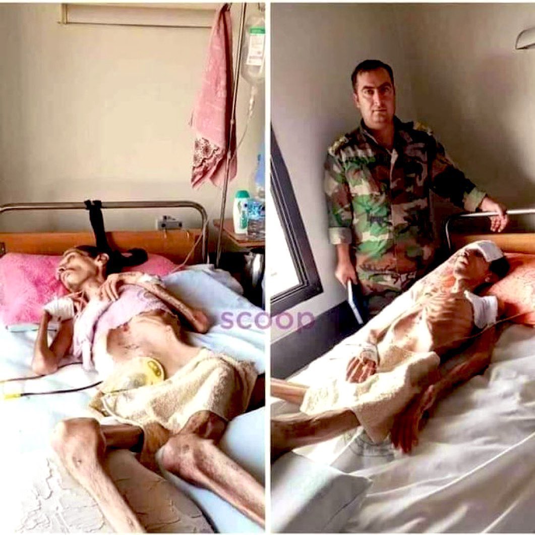 Ey Türkler, İran'ın Türkiye içindeki faaliyetlerine dikkat edin ki, Levant'ta, Irak'ta, Yemen'de Müslüman kardeşlerinize yaptıklarını size yapmasınlar.

Bu, Şii olan Beşar Esad'ın Suriye'deki kuralıdır. Yıllarca hapishanelerde Müslümanları aç bırakmıştır. Haçlılar, Endülüs'te