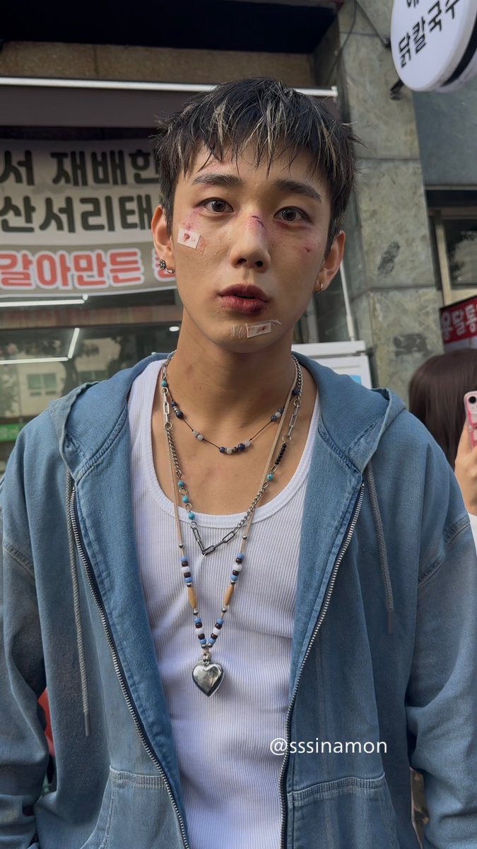 pqwriy's tweet photo. 음방 출연하는데 너무 많이 맞은 아이 ㅅㅂ https://t.co/mJfvYdFpOU