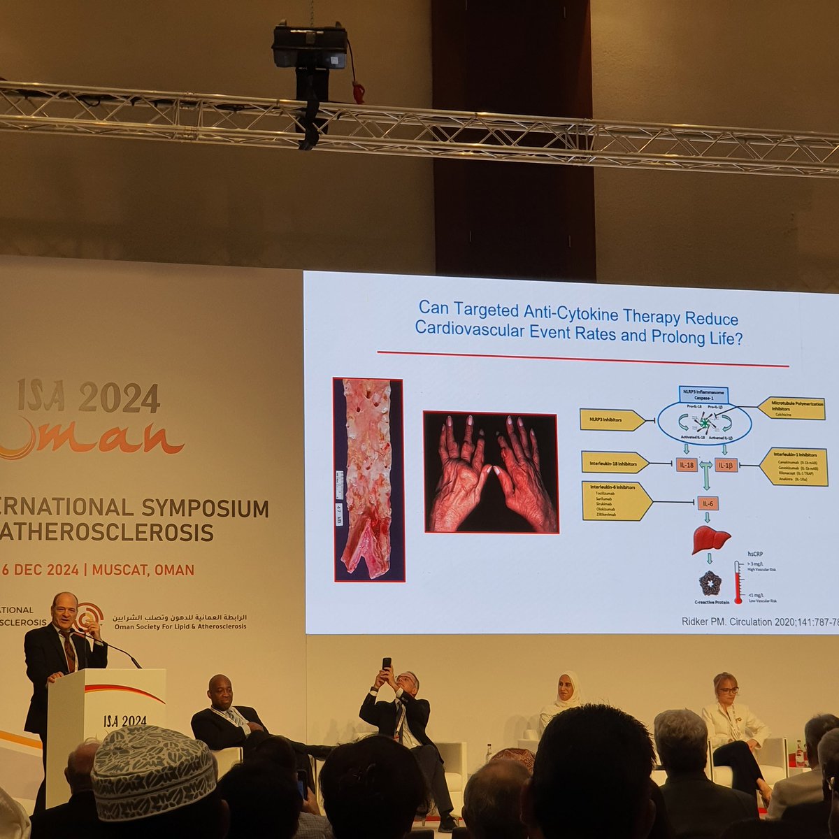 Hasanain90's tweet photo. 🚨Plenary session:
Recent trials in cardiometabolic medicine 
 📌Delivered by @Paul Ridker, USA
(Akira Endo Award winner)
#ISA2024 
@atherosociety 
@OslaOman https://t.co/vTQuO3XZlI