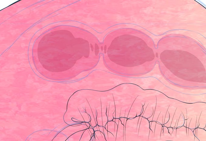 ããã°ã«ããã¯ã¹ãã£ãã¡ãã£ãšãŸãã«èŠãããŠãšããããããŒãããŠãããã§ãæé¢å³äœæ¥ã§æãåºããŠé©åœã«åŒã䌞ã°ããŠã¹ã¯ãªãŒã³ã§è²Œãä»ããã ãã§ééãã£ãœã質æã«âŠ!!æªããªãâŠ