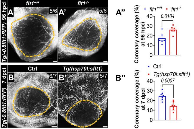 Development (@dev_journal) on Twitter photo flt1 inactivation promotes zebrafish cardiac regeneration by enhancing endothelial activity and limiting the fibrotic response
Read this #OpenAccess Research Article by Zhen-Yu Wang, <a href="/rmarinjuez/">Rubén Marín-Juez</a> and colleagues:
journals.biologists.com/dev/article/15… flt1 inactivation promotes zebrafish cardiac regeneration by enhancing endothelial activity and limiting the fibrotic response
Read this #OpenAccess Research Article by Zhen-Yu Wang, <a href="/rmarinjuez/">Rubén Marín-Juez</a> and colleagues:
journals.biologists.com/dev/article/15…