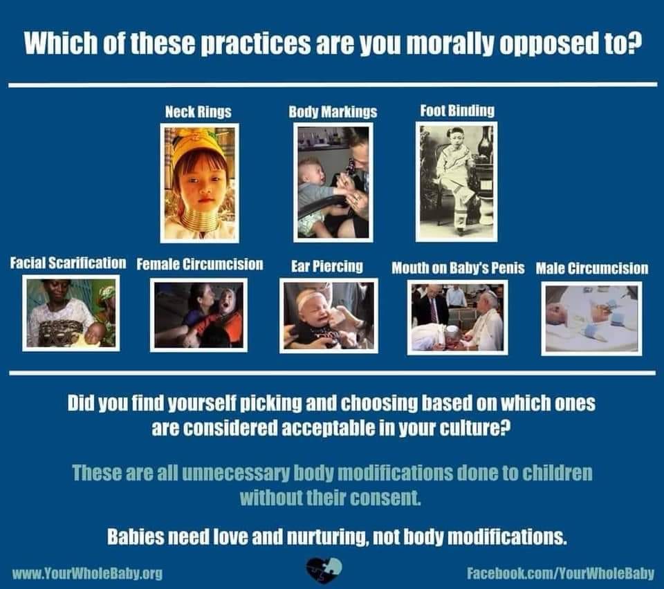 TheGuardianAn15's tweet image. What a silly demand. #Intactivists aren't the ones who are nuts!

Dear reader, please leave children alone, and keep #YourWholeBaby! YourWholeBaby.org

If you're new to the topic, see #CIRCUMCISION: Elephant in the Hospital:
youtube.com/watch?v=Ceht-3…

See ALT for more, share!