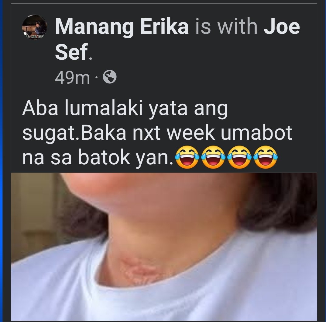 Mel_Chor2021's tweet photo. Self-inflicted?

A lunatic narcissist will do anything to attract attemtion and pity. https://t.co/AM1l5tWQYs