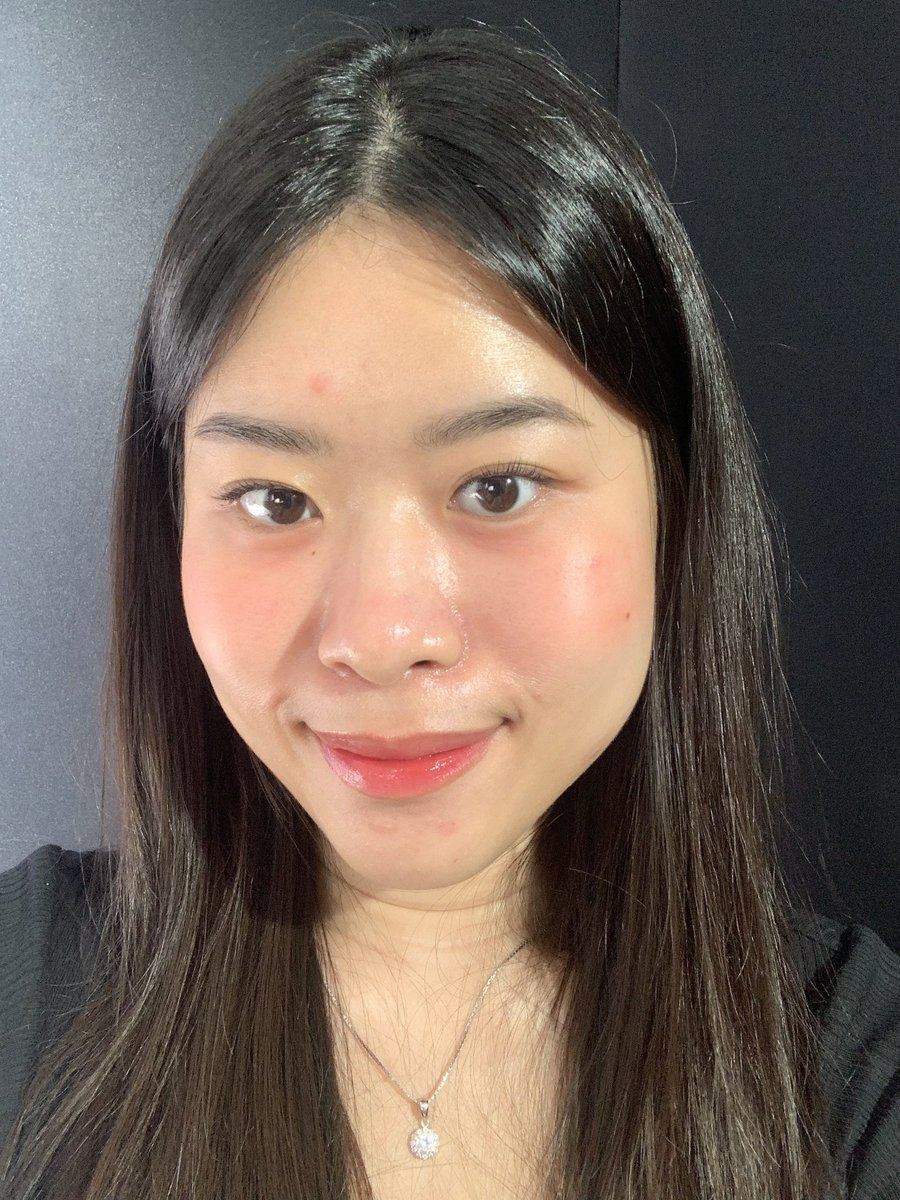__youres's tweet photo. dari yang merah-merah kayak gini, tapi jadi hilang &amp; flawless banget‼️🫵🏻

ADA YANG BISA TEBAK GAK INI PAKE APA😳

 before                                             after https://t.co/sBCwSFL4cM