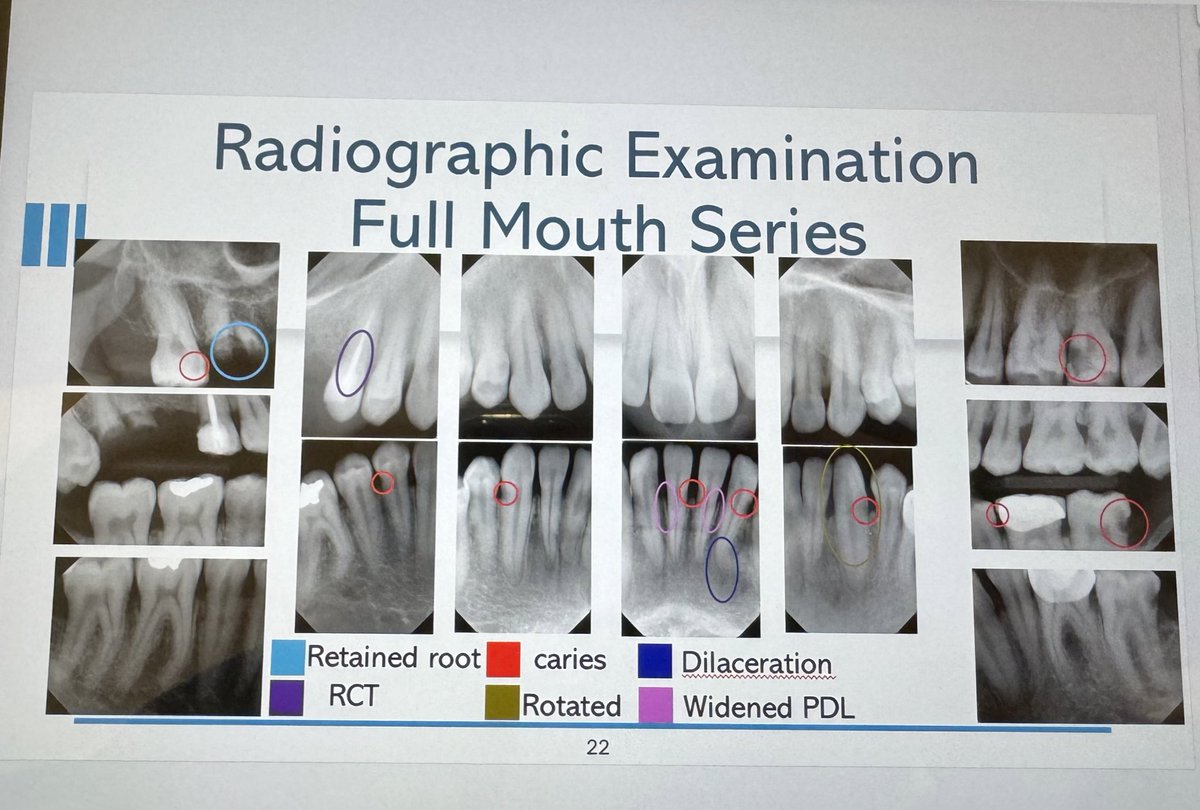 Case presentation 🦷