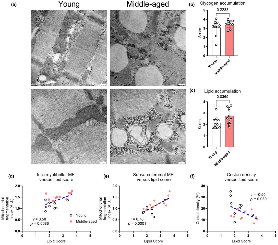Skeletal muscle mitochondrial fragmentation predicts age-associated decline in physical capacity

onlinelibrary.wiley.com/doi/10.1111/ac…