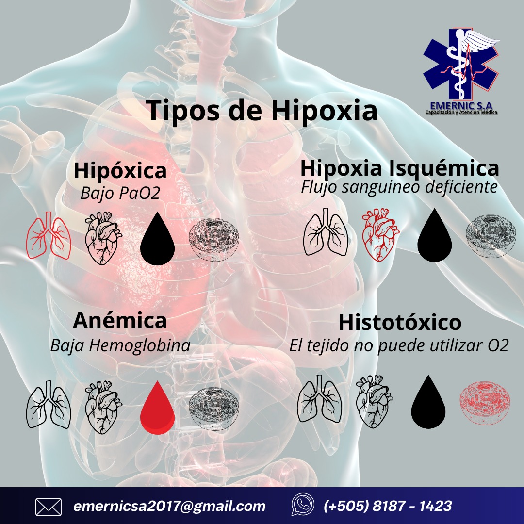EmernicSA's tweet photo. 🩺🩻🩸🦠❤Tipos de Hipoxia https://t.co/hKnVRpTskU