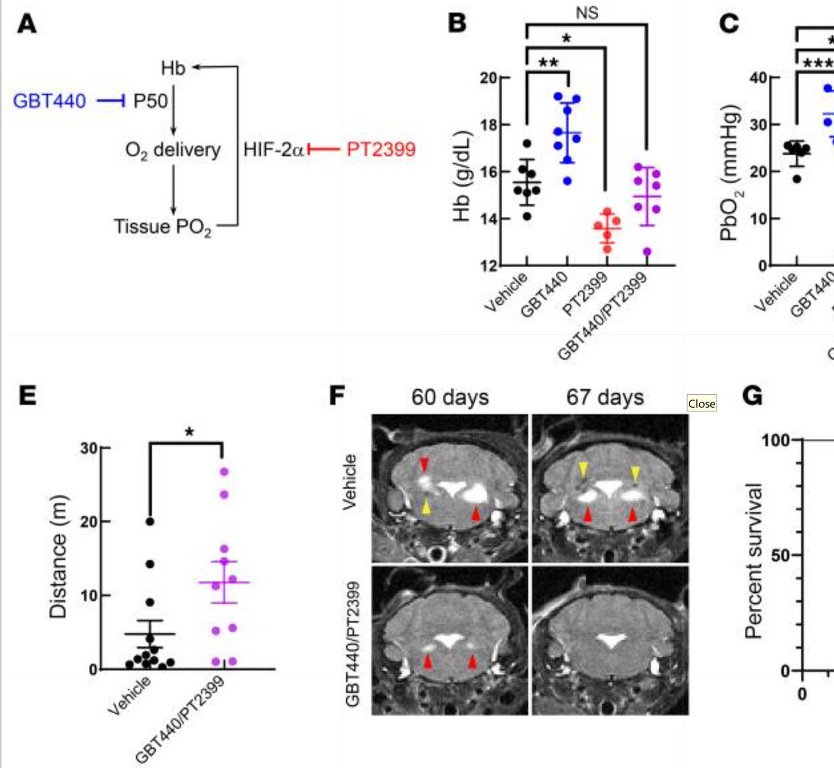 Catalina Vasilescu, PhD (@_cvasilescu) on Twitter photo Last 2 weeks of research on #mitochondrialdisease 📚
biomed.news/bims-mitdis/20…
biomed.news/bims-mitdis/20…
Therapeutic hypoxia for mt disease via enhancement of Hgb affinity and inhibition of HIF-2α
<a href="/Bims_BiomedNews/">Bims: Biomed News</a> <a href="/gavinmcstay2/">Gavin McStay</a> <a href="/mitoscientist/">Keshav K Singh, PhD</a> <a href="/mitoscientists/">MitoScientists</a> <a href="/MitoAging/">Mitochondria & Aging</a> <a href="/Mito_News/">Mitochondria News</a> Last 2 weeks of research on #mitochondrialdisease 📚
biomed.news/bims-mitdis/20…
biomed.news/bims-mitdis/20…
Therapeutic hypoxia for mt disease via enhancement of Hgb affinity and inhibition of HIF-2α
<a href="/Bims_BiomedNews/">Bims: Biomed News</a> <a href="/gavinmcstay2/">Gavin McStay</a> <a href="/mitoscientist/">Keshav K Singh, PhD</a> <a href="/mitoscientists/">MitoScientists</a> <a href="/MitoAging/">Mitochondria & Aging</a> <a href="/Mito_News/">Mitochondria News</a>