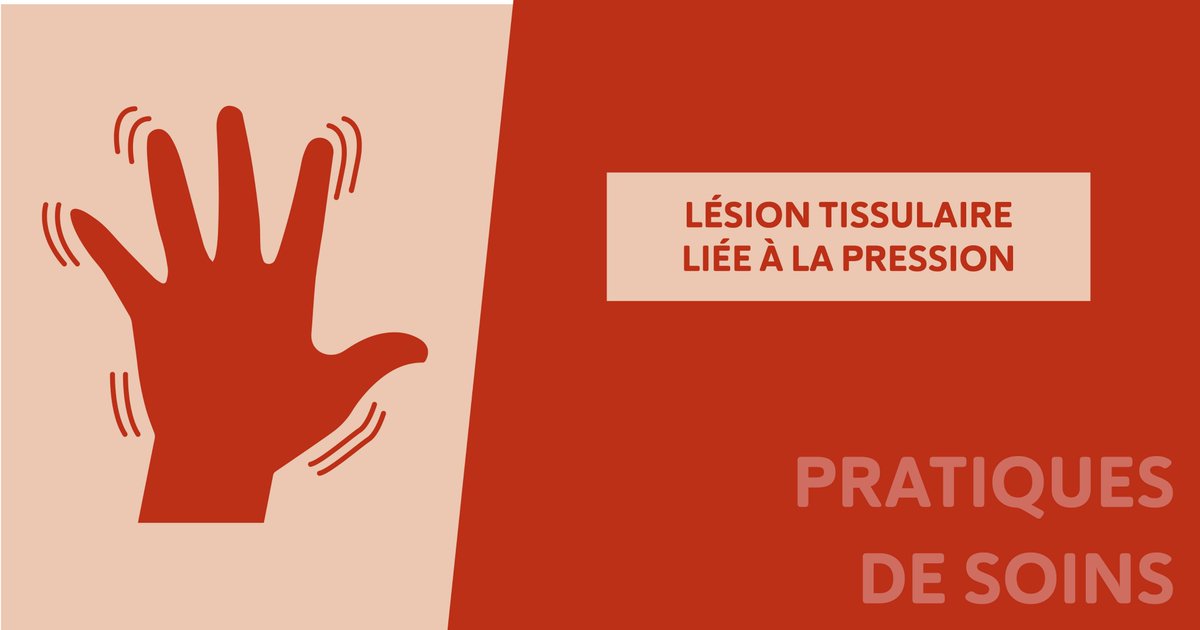 Competence_4's tweet photo. Les lésions tissulaires liées à la pression résultent le plus souvent d'une compression continue de la peau et des tissus sous-jacents. Elles surviennent parfois après seulement une heure de pression continue ➡ https://t.co/lOelNdNuRg https://t.co/6C0dCTSHJO