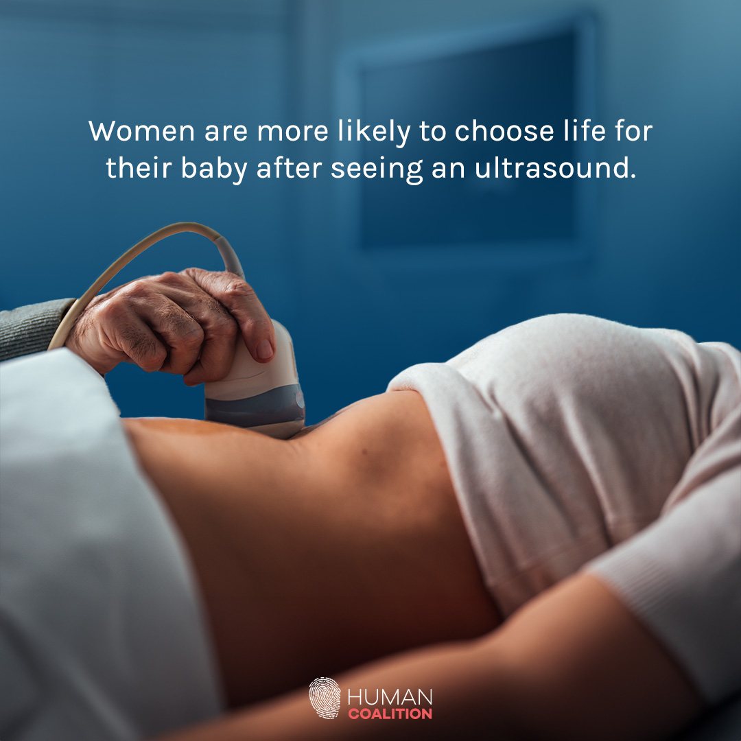 HumanCoalition's tweet image. There’s no denying the precious life growing inside a mother’s womb. 

#SaveTheBabyHumans #LifeIsAHumanRight #ValueLife #ChooseLife #EndAbortion #Abortion #ProLife #RescueThePreborn #HelpHurtingWomen #HelpTheHurting #HelpTheVulnerable #Preborn #RestoreFamilies