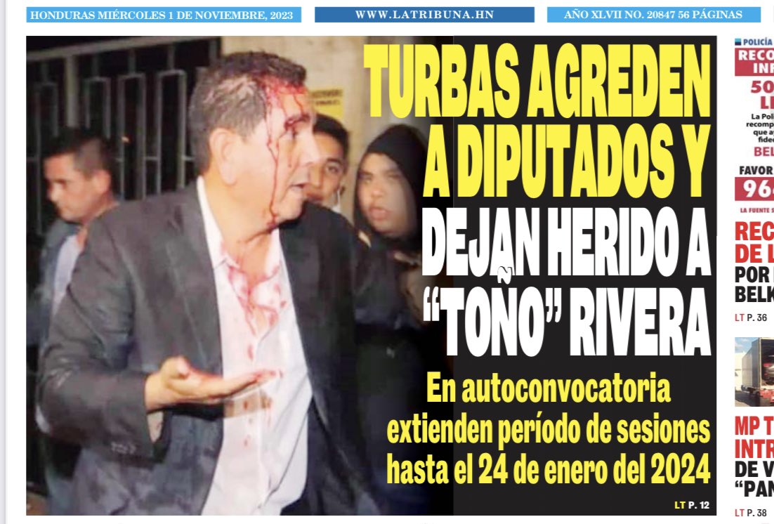 Eso fue exactamente lo q me pasó a mi persona , la diferencia es el procedimiento , al Presidente Lula le hicieron una craneotomia para reducir el hematoma subdural, mientras a mi persona para reducir los 2 hematomas subdurales se realizó el procedimiento de embolizacion de la