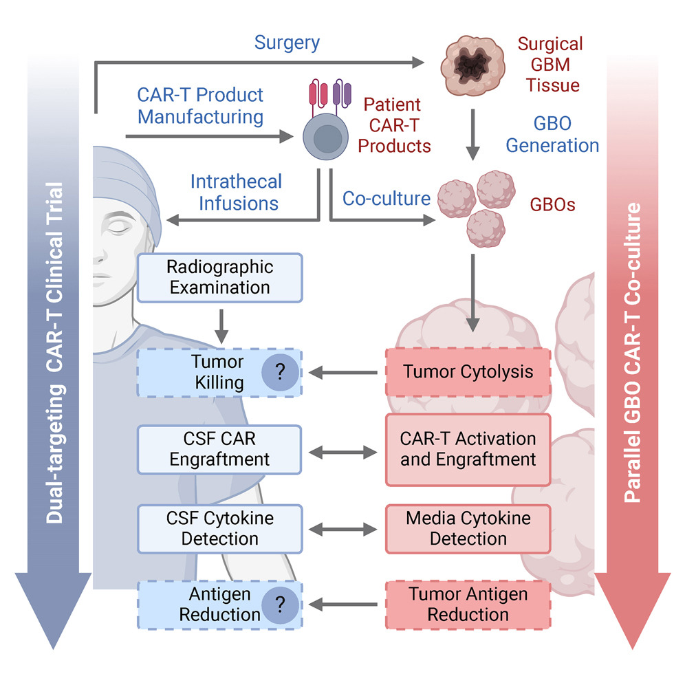 Penn Neurosurgery (@pennnsg) on Twitter photo Now online in <a href="/CellStemCell/">Cell Stem Cell</a>, our researchers used #glioblastoma organoids to assess CAR-T clinical trial responses in real time.
<a href="/DrORourke2/">DrORourke</a> <a href="/StephenBagleyMD/">Stephen Bagley</a> <a href="/LogunMeghan/">Meghan Logun</a> <a href="/sun_yusha/">Yusha Sun</a> <a href="/XinW_up/">Xin Wang</a> <a href="/UPenn_SongMing/">Song and Ming Labs</a> <a href="/MacNasrallah/">MacLean Nasrallah</a> <a href="/danzhang122/">Daniel Zhang</a> <a href="/EmilyllPai/">Emily Pai, MD PhD</a>
➡️ spr.ly/6015Quxh9 Now online in <a href="/CellStemCell/">Cell Stem Cell</a>, our researchers used #glioblastoma organoids to assess CAR-T clinical trial responses in real time.
<a href="/DrORourke2/">DrORourke</a> <a href="/StephenBagleyMD/">Stephen Bagley</a> <a href="/LogunMeghan/">Meghan Logun</a> <a href="/sun_yusha/">Yusha Sun</a> <a href="/XinW_up/">Xin Wang</a> <a href="/UPenn_SongMing/">Song and Ming Labs</a> <a href="/MacNasrallah/">MacLean Nasrallah</a> <a href="/danzhang122/">Daniel Zhang</a> <a href="/EmilyllPai/">Emily Pai, MD PhD</a>
➡️ spr.ly/6015Quxh9