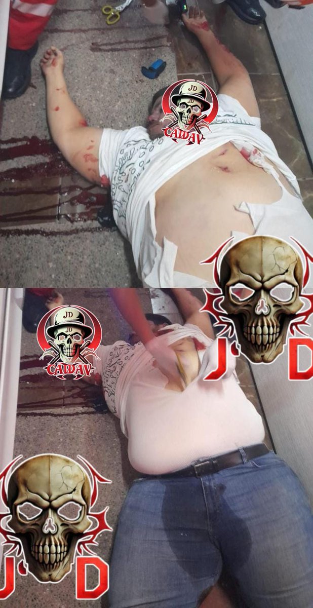JPablo_CA's tweet photo. En un ataque armado, "El Gordo #Peruci" perdió la vida en Culiacán el 9 de diciembre de 2024. La violencia también cobró la vida de su esposa, quien murió tras ser herida en el atentado.
— Más detalles en https://t.co/9HNDfatvXy

https://t.co/cusXphkd56