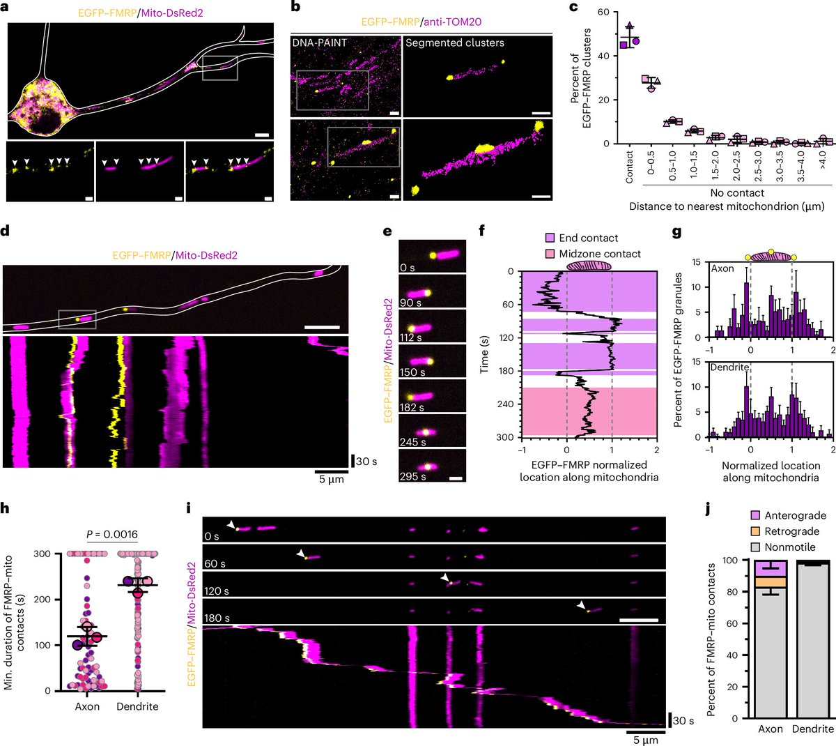 Penn Medicine CSO (@pennmedcso) on Twitter photo FMRP, MFF translation & mitochondrial fission in neurons ft. Adam Fenton, Ruchao Peng, <a href="/Charlie_R_Bond/">Charlie Bond</a>, <a href="/SHugelier/">Siewert Hugelier</a>, @Melike_Lak, <a href="/yiweichang/">Yi-Wei Chang</a>, <a href="/ErikaHolzbaur/">Erika Holzbaur-Howland</a> & Thomas Jongens <a href="/BB_UPenn/">UPenn Dept of Biochem & Biophys</a> <a href="/UPennPhysiology/">UPenn Physiology</a> <a href="/PennGenetics/">Penn Genetics</a> @ISBUPenn <a href="/PennMuscle/">PennMuscle</a> <a href="/CAMBUpenn/">CAMB Graduate Group</a> nature.com/articles/s4155… FMRP, MFF translation & mitochondrial fission in neurons ft. Adam Fenton, Ruchao Peng, <a href="/Charlie_R_Bond/">Charlie Bond</a>, <a href="/SHugelier/">Siewert Hugelier</a>, @Melike_Lak, <a href="/yiweichang/">Yi-Wei Chang</a>, <a href="/ErikaHolzbaur/">Erika Holzbaur-Howland</a> & Thomas Jongens <a href="/BB_UPenn/">UPenn Dept of Biochem & Biophys</a> <a href="/UPennPhysiology/">UPenn Physiology</a> <a href="/PennGenetics/">Penn Genetics</a> @ISBUPenn <a href="/PennMuscle/">PennMuscle</a> <a href="/CAMBUpenn/">CAMB Graduate Group</a> nature.com/articles/s4155…